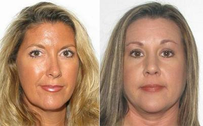 Angela Nolen (trái) và đồng phạm là Cathy Bennett Angela Nolen (trái) và đồng phạm là Cathy Bennett