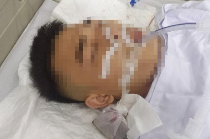 Nạn nhân bị đạn bắn trúng khiến thương tích nặng