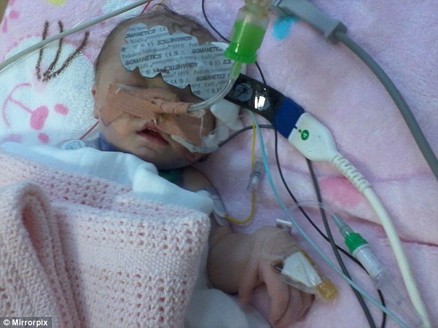 Bé sơ sinh nhỏ tuổi nhất thế giới được phẫu thuật tim ảnh 1