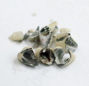 Mẹ thẩm mỹ răng hỏng, con khóc thét ảnh 3