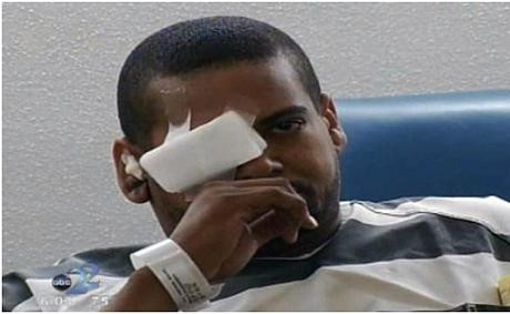 Nghi phạm vụ án