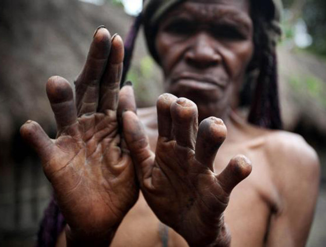 Bộ lạc Dani - Indonesia ngày nay vẫn lưu giữ nghi thức kỳ lạIkipalin - phong tục truyền thống cắt phần đầu ngón tay để xua đuổi tà ma khi người thân mất