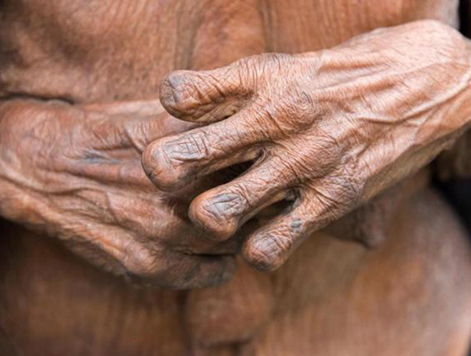 Họ cho rằng, việc cắt đầu ngón tay sẽ khiến cho linh hồn của người quá cố được ra đi thanh thản, theo đó, các em bé cũng bị người mẹ cắt đầu ngón tay