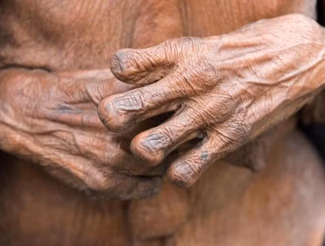 Họ cho rằng, việc cắt đầu ngón tay sẽ khiến cho linh hồn của người quá cố được ra đi thanh thản, theo đó, các em bé cũng bị người mẹ cắt đầu ngón tay