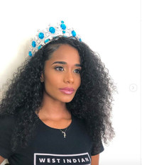 Nhan sắc gây tranh cãi của tân 