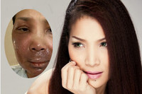 1 tháng sau vụ bỏng, Hồng Ngọc xuất hiện với hình ảnh không thể tin nổi