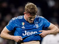 [ẢNH] Trung vệ đắt giá đổ máu vẫn không cứu nổi Juve