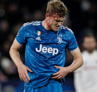 [ẢNH] Trung vệ đắt giá đổ máu vẫn không cứu nổi Juve