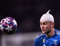 [ẢNH] Trung vệ đắt giá đổ máu vẫn không cứu nổi Juve