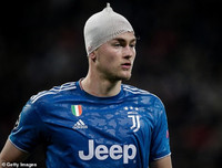 [ẢNH] Trung vệ đắt giá đổ máu vẫn không cứu nổi Juve