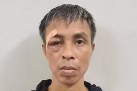 Đâm chết bệnh nhân cùng phòng do... buồn chán