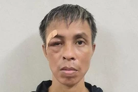 Đâm chết bệnh nhân cùng phòng do... buồn chán