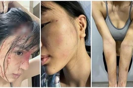 Cơ quan điều tra nói gì về vụ siêu mẫu Khả Trang tố bị bạo lực ?