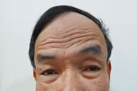 'Sở hữu' 4 tiền án, cai thầu xây dựng tiếp tục phạm tội