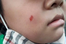 Phụ huynh tát cô giáo ở Đà Nẵng: Cả hai bên đều bị kỷ luật, phạt hành chính