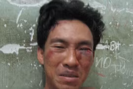 Nửa giờ giải cứu bé gái 8 tuổi thoát khỏi lưỡi dao của tên trộm hung tợn 