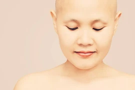 Tang lễ giản dị của “người hùng” Thương Sobey tại Australia