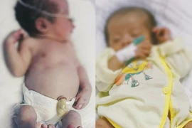 Điều trị thành công cho bé sơ sinh mắc bệnh giang mai