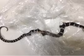 Cứu sống bé trai bị rắn cặp nia cắn