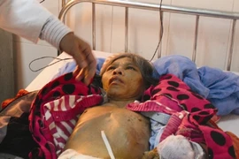 Đang điều tra vụ osin tố chủ hành hạ như thời trung cổ