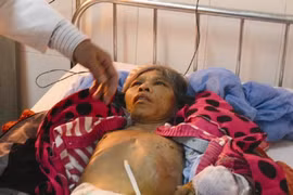 Đang điều tra vụ osin tố chủ hành hạ như thời trung cổ