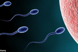 Dùng sóng siêu âm “diệt” tinh trùng để tránh thai