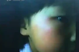 Không biết làm toán, bé mẫu giáo bị cô tát 70 cái