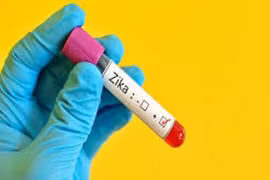 Mỹ thử nghiệm vaccine phòng virus Zika trên người