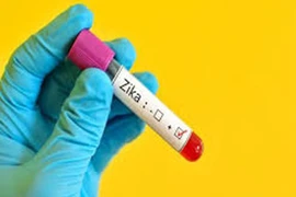Mỹ thử nghiệm vaccine phòng virus Zika trên người