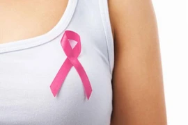 Những cách phòng ngừa tái phát ung thư vú