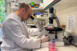 Tổ chức Y tế thế giới (WHO): Cảnh báo nguy cơ dịch đậu mùa khỉ bùng phát toàn châu Âu