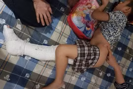 Vụ học sinh bị gãy chân ở trường Tiểu học Nam Trung Yên: Lái xe có bị xử lý?