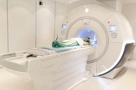 Đột quỵ não và vai trò của chụp cộng hưởng từ (MRI) trong tầm soát đột quỵ