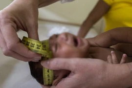 Audio 12-4-2016: Mỹ cảnh báo, virus Zika có thể gây ra hàng loạt biến chứng trong thai kỳ