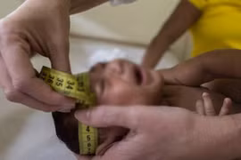 Audio 12-4-2016: Mỹ cảnh báo, virus Zika có thể gây ra hàng loạt biến chứng trong thai kỳ