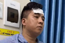 Truy bắt nhanh kẻ sát hại người phụ nữ trong nhà nghỉ