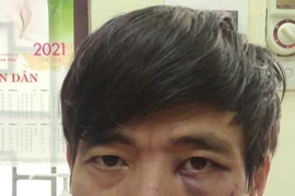 Khởi tố kẻ mặc đồng phục Grab, dùng mìn giả cướp tiền tại ngân hàng