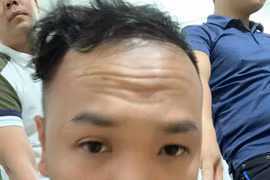 Kỳ án lật tẩy bộ mặt kẻ môi giới bệnh hoạn, ép các cô gái trẻ phải bán dâm