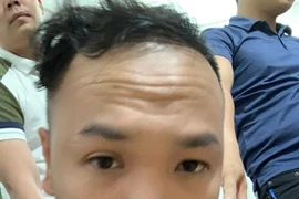 Kỳ án lật tẩy bộ mặt kẻ môi giới bệnh hoạn, ép các cô gái trẻ phải bán dâm