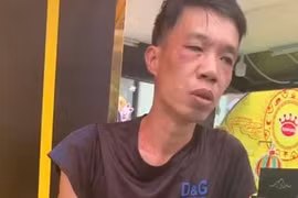 Chặn bắt tên trộm đang phóng xe máy tìm đường tẩu thoát