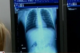 Kiểm soát chặt đối tượng đánh cắp và nuốt viên kim cương trị giá 20.000 USD