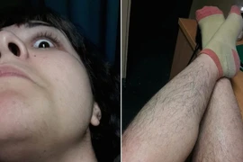 Cô gái xinh đẹp thích khoe ảnh cơ thể đầy lông 