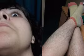 Cô gái xinh đẹp thích khoe ảnh cơ thể đầy lông 