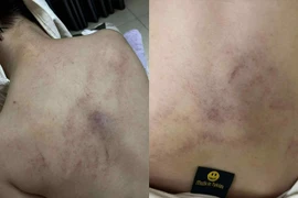 Tạm đình chỉ công tác 2 giáo viên mầm non Gia Thụy nghi bạo hành trẻ