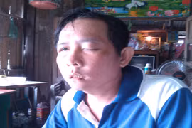 Nhổ răng làm mù mắt, người đàn ông gửi đơn "kêu cứu"