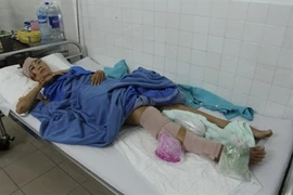 "Nữ hoàng điền kinh" Trương Thanh Hằng bị tông gãy chân