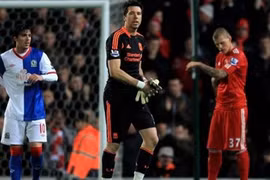 Liverpool suýt trả giá vì... thủ môn