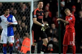 Liverpool suýt trả giá vì... thủ môn