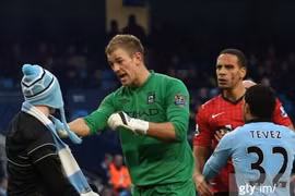 Ferdinand đổ máu trong trận derby