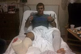 Arsenal lại gặp tin dữ